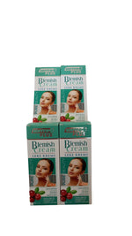 SOFTTO PLUS Blemish Cream 75 ml x 4 - Aegean Vibe